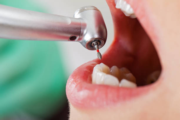 Best Pediatric Emergency Dentist in Poydras, LA